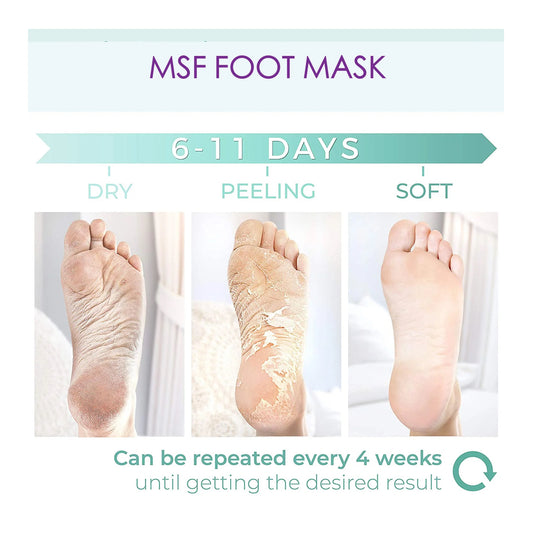 MSF Foot Mask